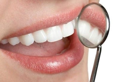 Dental Implants, New Smile, Carolina's Dental Choice, Dental Experts, Pretty Teeth, Clean Smile, Monroe NC