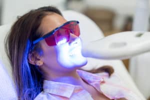 Charlotte Laser Teeth Whitening