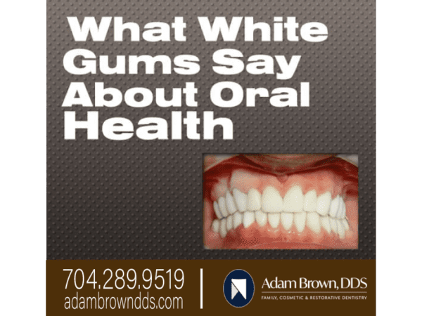 What Do White Gums Say About Oral Health Adam Brown Dentistry