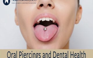 Oral Piercings and Dental Health Monroe, NC
