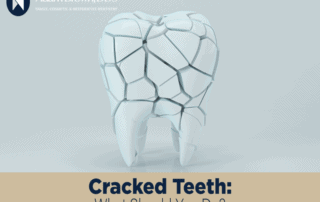 Cracked Teeth Help Charlotte NC