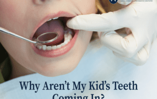 Kids Teeth Not Coming In