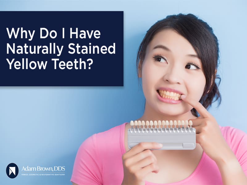 Tips to Avoid Yellow Teeth