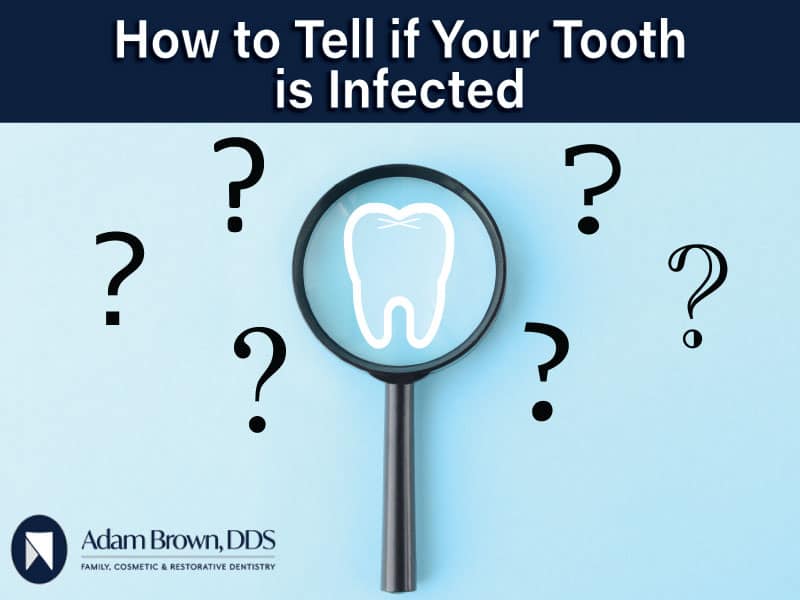 How to Know If Your Tooth is Infected