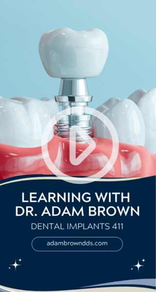 YouTube Short Explaining Dental Implants - Part 3